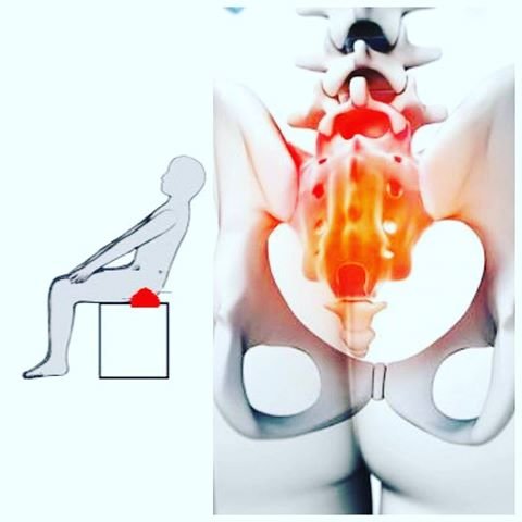 dolor al sentarse en el sacro